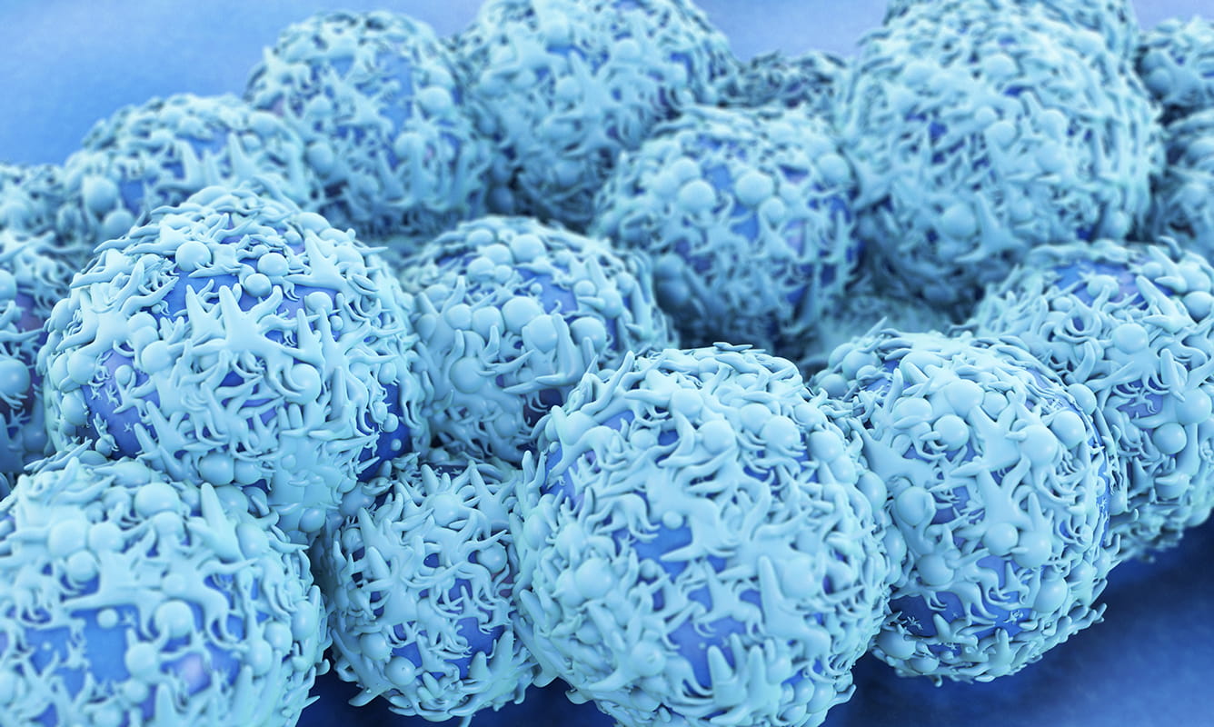 image of cervical cancer cells