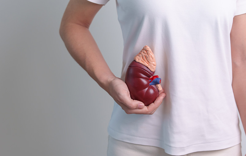 A woman holds an anatomical model of a kidney.